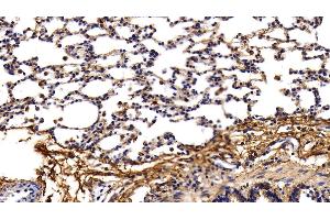 Detection of PINP in Rat Lung Tissue using Polyclonal Antibody to Procollagen I N-Terminal Propeptide (PINP) (PINP antibody  (AA 23-151))