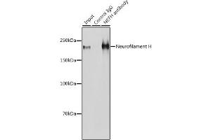 Immunoprecipitation analysis of 600 μg extracts of Mouse brain cells using 3 μg Neurofilament H antibody (ABIN6129638, ABIN6144512, ABIN6144513 and ABIN6224502).