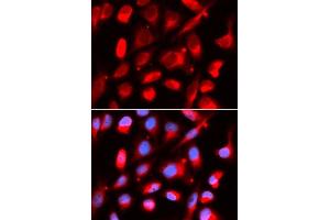 Immunofluorescence analysis of U2OS cells using UROD antibody. (UROD antibody  (AA 1-367))