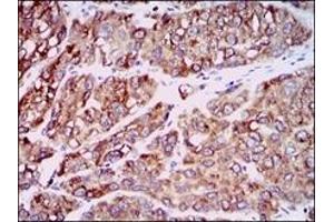 Immunohistochemistry (IHC) image for anti-Chemokine (C-C Motif) Ligand 2 (CCL2) antibody (ABIN1108180) (CCL2 antibody)