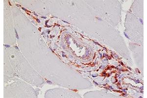 Paraffin embedded mouse adductor muscle day 7 post femoral artery ligation was stained with anti-Mac-3 followed by Goat Anti-Rat IgG(H+L), Mouse ads-BIOT (Goat anti-Rat IgG (Heavy & Light Chain) Antibody (Biotin))