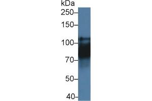 Detection of CDH16 in Rat Kidney lysate using Polyclonal Antibody to Cadherin 16 (CDH16) (Cadherin-16 antibody  (AA 353-617))