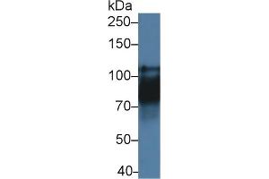 Detection of CDH16 in Rat Kidney lysate using Polyclonal Antibody to Cadherin 16 (CDH16)