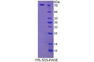 Image no. 1 for Cortactin (CTTN) (AA 1-509) protein (His tag) (ABIN4989082)