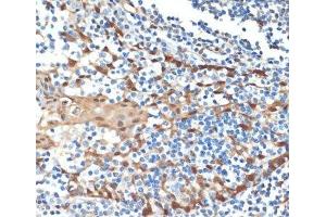 Immunohistochemistry of paraffin-embedded Human tonsil using HSPA1A Monoclonal Antibody at dilution of 1:100 (40x lens). (HSP70 1A antibody)