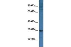 Image no. 1 for anti-BCL2/adenovirus E1B 19kDa Interacting Protein 3-Like (BNIP3L) (AA 92-141) antibody (ABIN6747290) (BNIP3L/NIX antibody  (AA 92-141))