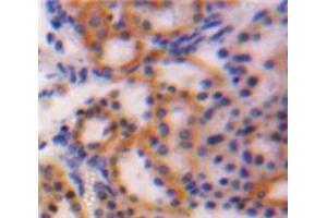 Used in DAB staining on fromalin fixed paraffin-embedded Kidney tissue (CTGF antibody  (AA 25-348))