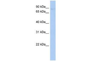 WB Suggested Anti-PLOD2 Antibody Titration:  0. (PLOD2 antibody  (Middle Region))