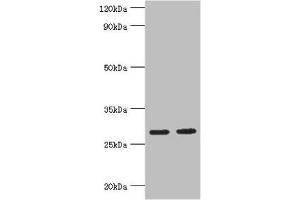 Western blot All lanes: Ubiquitin-conjugating enzyme E2 J2 antibody at 5 μg/mL Lane 1: HepG2 whole cell lysate Lane 2: Rat small intestine tissue Secondary Goat polyclonal to rabbit IgG at 1/10000 dilution Predicted band size: 29, 25, 31 kDa Observed band size: 29 kDa