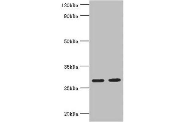 UBE2J2 anticorps  (AA 1-230)