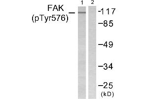 Western blot analysis of extracts from NIH/3T3 cells, using FAK (Phospho-Tyr576) Antibody (#A0426). (FAK antibody  (pTyr576))