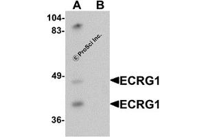 Western Blotting (WB) image for anti-Transmembrane Protease, Serine 11A (TMPRSS11A) (C-Term) antibody (ABIN1030374)