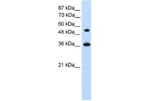 WB Suggested Anti-HOXC11 Antibody Titration:  1. (HOXC11 antibody  (Middle Region))