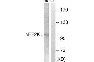 Western blot analysis of extracts from Jurkat cells, using eEF2K (Ab-359) antibody. (EEF2K antibody  (Ser359))