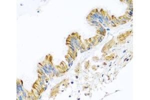 Immunohistochemistry of paraffin-embedded Human trachea using PCDHA12 Polyclonal Antibody at dilution of 1:100 (40x lens). (PCDHA12 antibody)