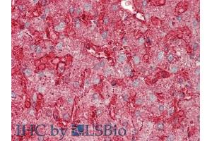 IHC-P analysis of Human Liver Tissue, with HE staining. (Annexin IV antibody  (AA 11-164))