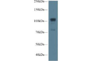 Western Blot; Sample: Human A549 cell lysate; Primary Ab: 1µg/ml Rabbit Anti-Rat NOS1 Antibody Second Ab: 0. (NOS1 antibody  (AA 468-616))