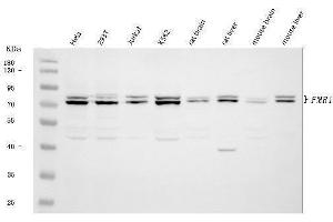 Western blot analysis of FMRP/FMR1 using anti-FMRP/FMR1 antibody (ABIN3042398). (FMR1 antibody  (N-Term))