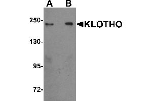 Western Blotting (WB) image for anti-Klotho (KL) (Middle Region) antibody (ABIN1030975)
