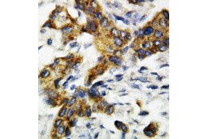 Immunohistochemistry (IHC) image for anti-BCL2-Antagonist/killer 1 (BAK1) (AA 74-95), (Middle Region) antibody (ABIN3044400)