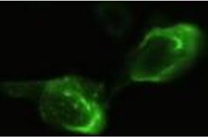 Anti-NEUROG3 mouse monoclonal antibody (NEUROG3) immunofluorescent staining of HeLa cells transiently transfected by pCMV6-ENTRY NEUROG3 (RC224767). (Neurogenin 3 antibody)