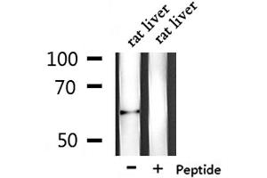 Western blot analysis of extracts from rat liver, using PLAT Antibody.