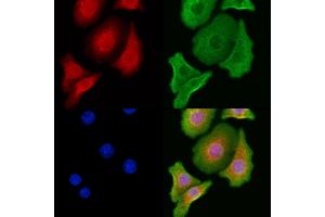 ABIN6262378 and ABIN6276997 staining Hela cells by IF/ICC.