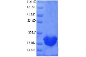 SDS-PAGE (SDS) image for T Cell Receptor beta Constant 1 (TRBC1) (AA 1-177), (full length) protein (His tag) (ABIN5713910) (TRBC1 Protein (AA 1-177, full length) (His tag))