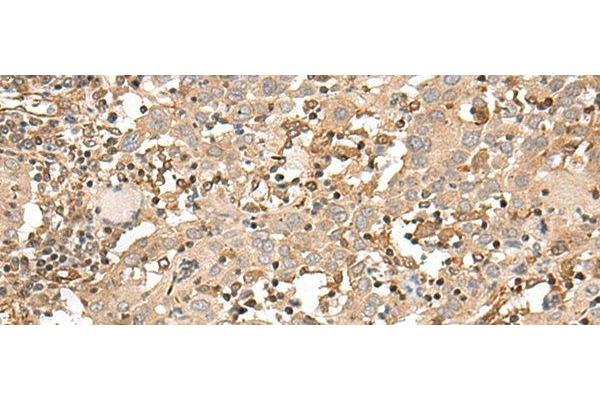 FSTL5 antibody