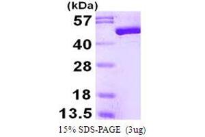 Enolase 3 (Beta, Muscle) (ENO3) (AA 1-434) (Active) protein (His tag)