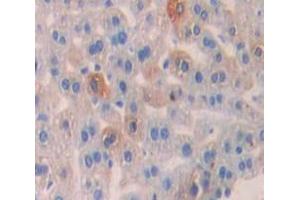 Figure. (DPYD antibody  (AA 169-422))