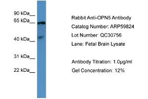 WB Suggested Anti-OPN5  Antibody Titration: 0. (OPN5 antibody  (C-Term))