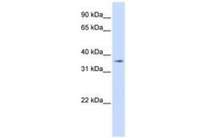 Image no. 1 for anti-Transmembrane Protein 30B (TMEM30B) (AA 108-157) antibody (ABIN6740901) (TMEM30B antibody  (AA 108-157))