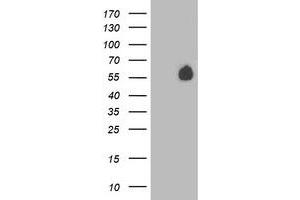 HEK293T cells were transfected with the pCMV6-ENTRY control (Left lane) or pCMV6-ENTRY PVRL1 (Right lane) cDNA for 48 hrs and lysed. (PVRL1 antibody)