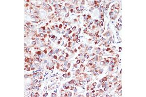 Immunohistochemistry (IHC) image for anti-Transferrin Receptor (p90, CD71) (TFRC) (AA 1-140) antibody (ABIN6149065)