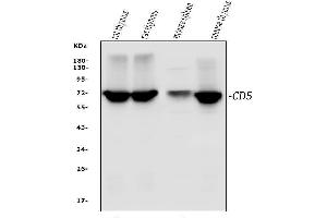 Western blot analysis of CD5 using anti-CD5 antibody (ABIN7600839).