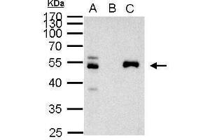 IP Image PAX8 antibody immunoprecipitates PAX8 protein in IP experiments. (PAX8 antibody)
