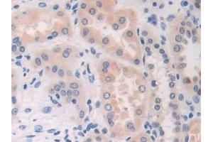 Detection of CDA in Human Kidney Tissue using Polyclonal Antibody to Cytidine Deaminase (CDA) (CDA antibody  (AA 2-146))