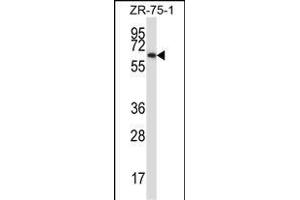 P17 Antibody (C-term) (ABIN657916 and ABIN2846863) western blot analysis in ZR-75-1 cell line lysates (35 μg/lane). (MMP17 antibody  (C-Term))