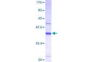 TRMT112 Protein (AA 1-125) (GST tag)