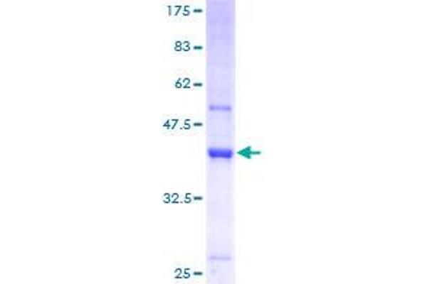 TRMT112 Protein (AA 1-125) (GST tag)