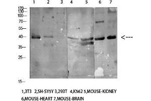 Western Blot (WB) analysis of specific cells using Antibody diluted at 1:1000. (KIR3DL1 antibody)