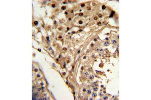 Formalin-fixed and paraffin-embedded human testis tissue reacted with KLF6 Antibody , which was peroxidase-conjugated to the secondary antibody, followed by DAB staining. (KLF6 antibody  (C-Term))