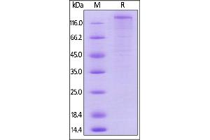 SDS-PAGE (SDS) image for Fms-Related tyrosine Kinase 1 (VEGFR1) (FLT1) (AA 23-759) (Active) protein (Fc Tag) (ABIN6253654)