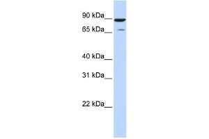 WB Suggested Anti-HIPK4 Antibody Titration: 0. (HIPK4 antibody  (Middle Region))