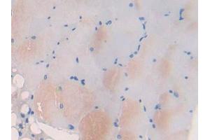 DAB staining on IHC-P; Samples: Mouse Skeletal muscle Tissue (Myosin IB antibody  (AA 779-1040))