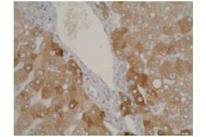 Staining using CYP2A6 antibody on normal human liver tissue at 1 µg/ml. (CYP2A6 antibody  (C-Term))