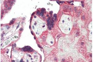 Human Placenta (formalin-fixed, paraffin-embedded) stained with TLR3 antibody ABIN461896 at 5 ug/ml followed by biotinylated goat anti-rabbit IgG secondary antibody ABIN481713, alkaline phosphatase-streptavidin and chromogen. (TLR3 antibody  (C-Term))