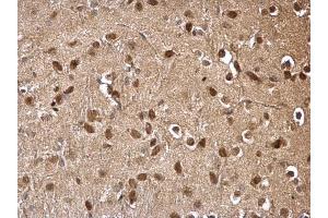 IHC-P Image DDB1 antibody [C3], C-term detects DDB1 protein at cytosol and nucleus on mouse hind brain by immunohistochemical analysis. (DDB1 antibody  (C-Term))