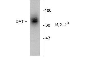 Image no. 1 for anti-Solute Carrier Family 6 (Neurotransmitter Transporter, Dopamine), Member 3 (SLC6A3) (Extracellular Loop) antibody (ABIN372614) (SLC6A3 antibody  (Extracellular Loop))